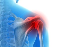 Baseball and Shoulder Injuries