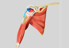 Subacromial Decompression